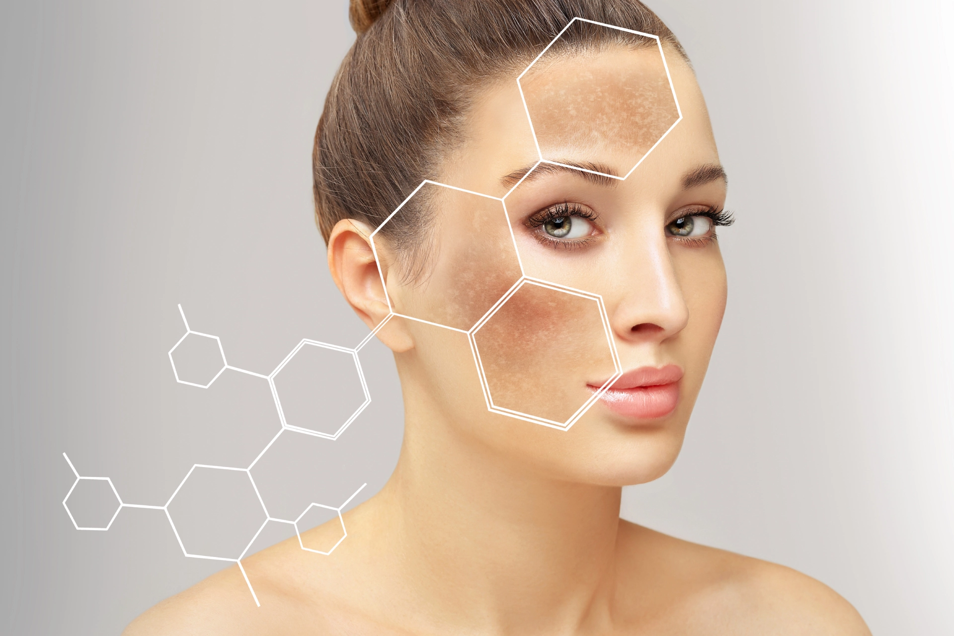 Beauty Terapi Leke Protokolü